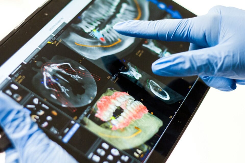Radiographie d'un patient chez l'orthodontiste