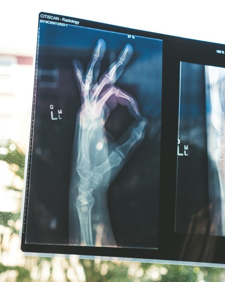 Radiographie d'une main qui fait le signe OK